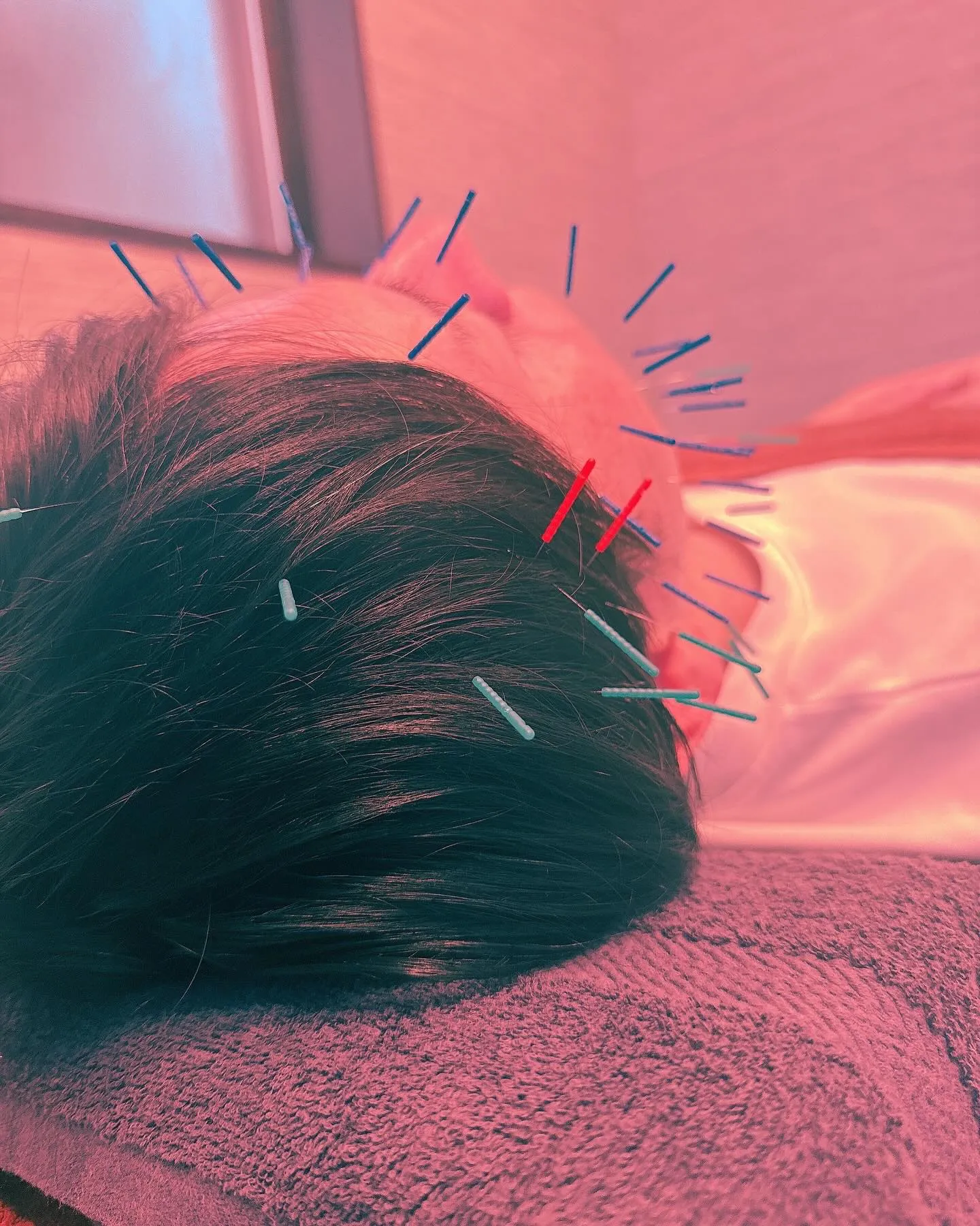 頭痛施術　首、肩の痛みでご来院された方です✨🐈‍⬛