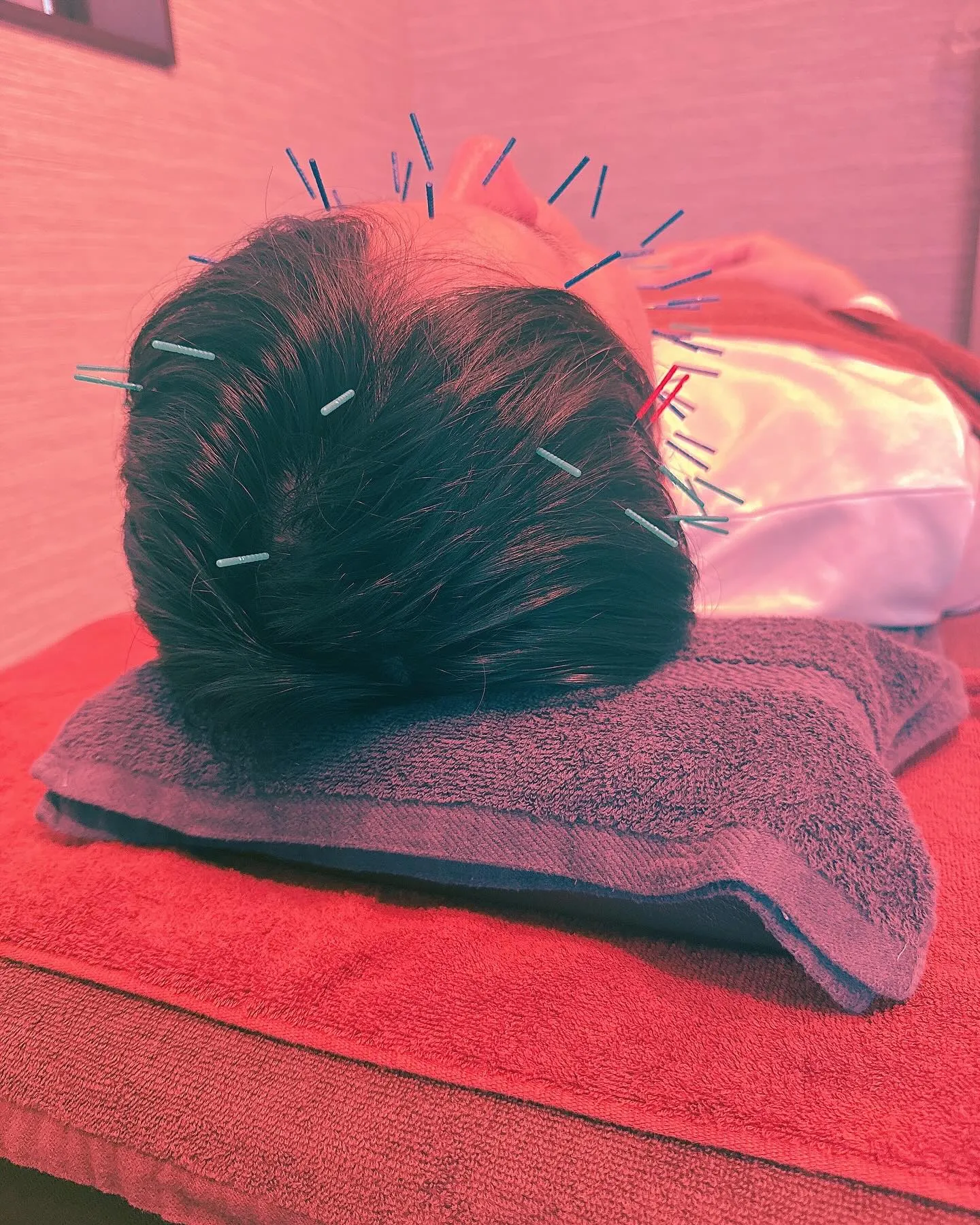 頭痛施術　首、肩の痛みでご来院された方です✨🐈‍⬛