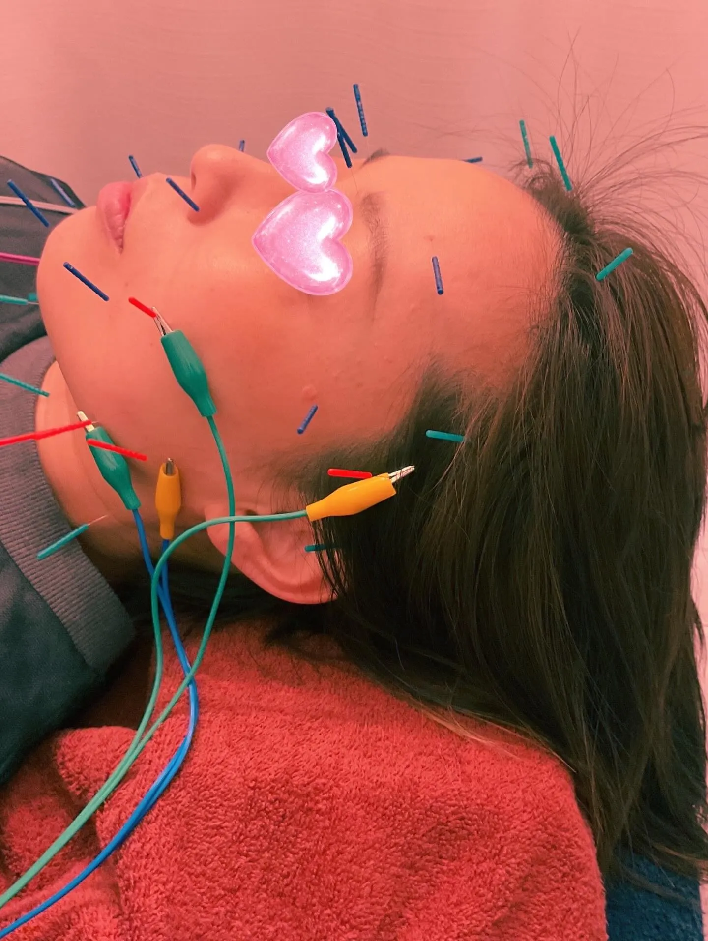 美容鍼46本🌟お久しぶりです🐈‍⬛